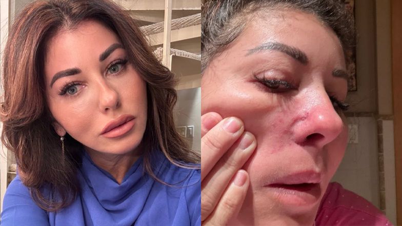 Nieudany zabieg Izzy Anaya