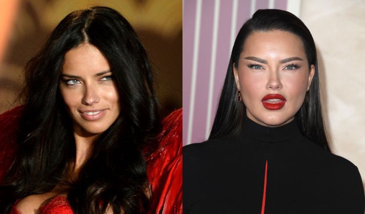 Adriana Lima zabrała głos w sprawie wyglądu jej twarzy