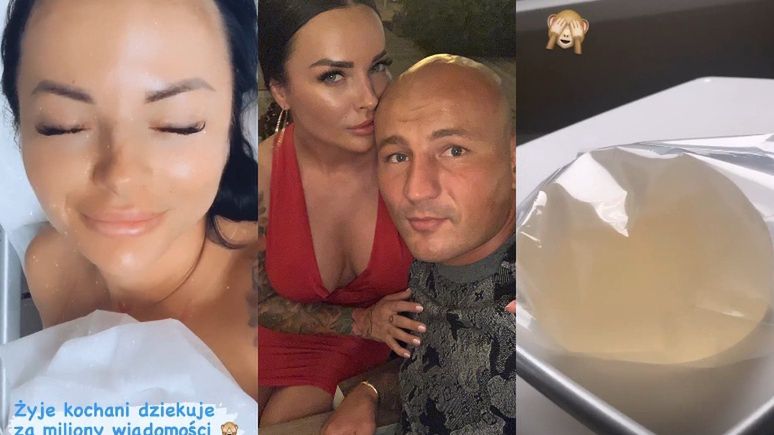 Dziewczyna Artura Szpilki usunęła implanty piersi