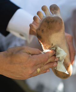 Brudna szyja i stopy. Afrodyzjaki z XVII w. przyprawiają o mdłości