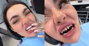 Zusje ZNOWU poprawiła sobie zęby. Internauci: "To jest jakiś dramat"