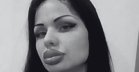 Nie żyje 35-letnia influencerka, którą okrzyknięto posiadaczką NAJWIĘKSZYCH UST na świecie