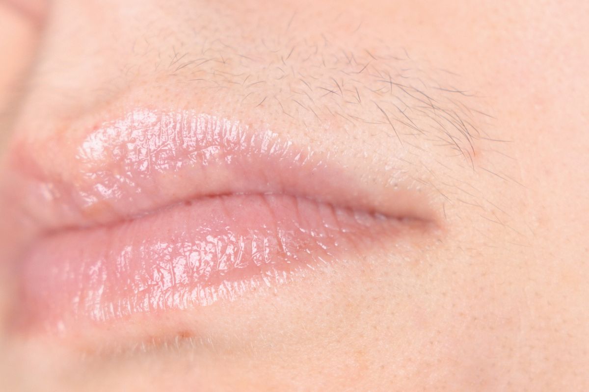 In the kitchen cupboard: Baking soda solution to female mustache