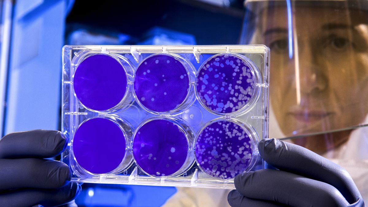 Przejście Covid-19 nie oznacza końca problemów