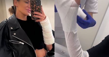 "Dobra pacjentka" Anna Lewandowska informuje, co z jej ręką po operacji
