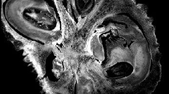 Niesamowite animowane warzywa po rezonansie magnetycznym 1