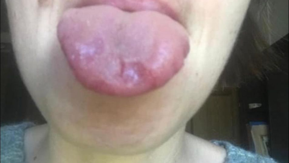 jezyk covid-19 koronawirus