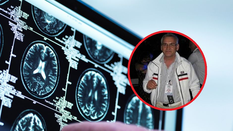 Te 4 rzeczy powoli wykańczają twój mózg