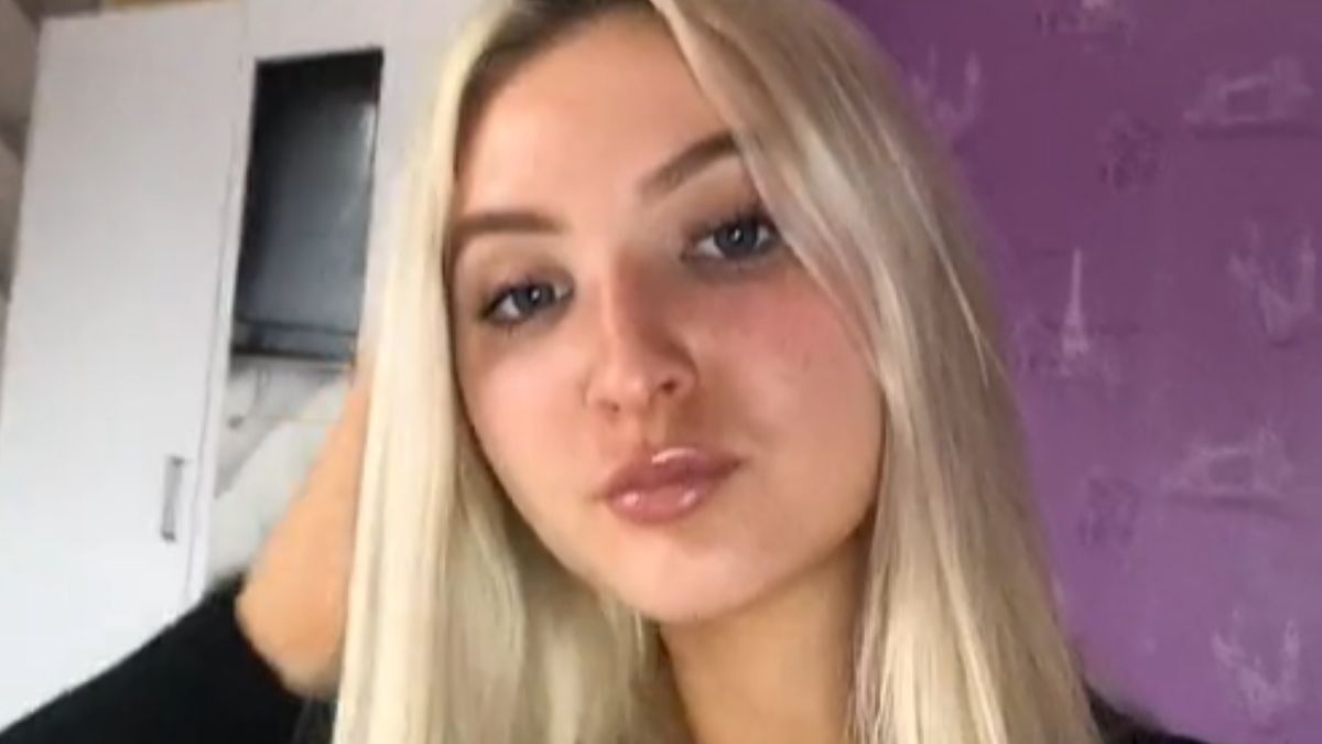 Internautka żałuje powiększenia ust