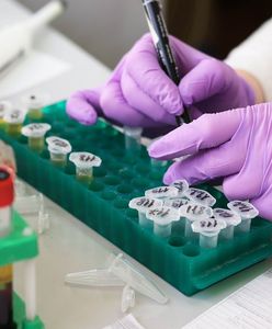 Wybuch pandemii COVID-19. WHO żąda kontroli laboratoriów w Chinach