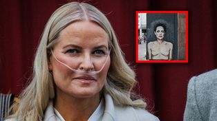 Księżna czeka na przeszczep. Norwegowie mówią o "efekcie Angeliny Jolie"