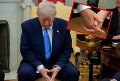Tajemniczy siniak na dłoni Trumpa. Biały Dom zabrał głos