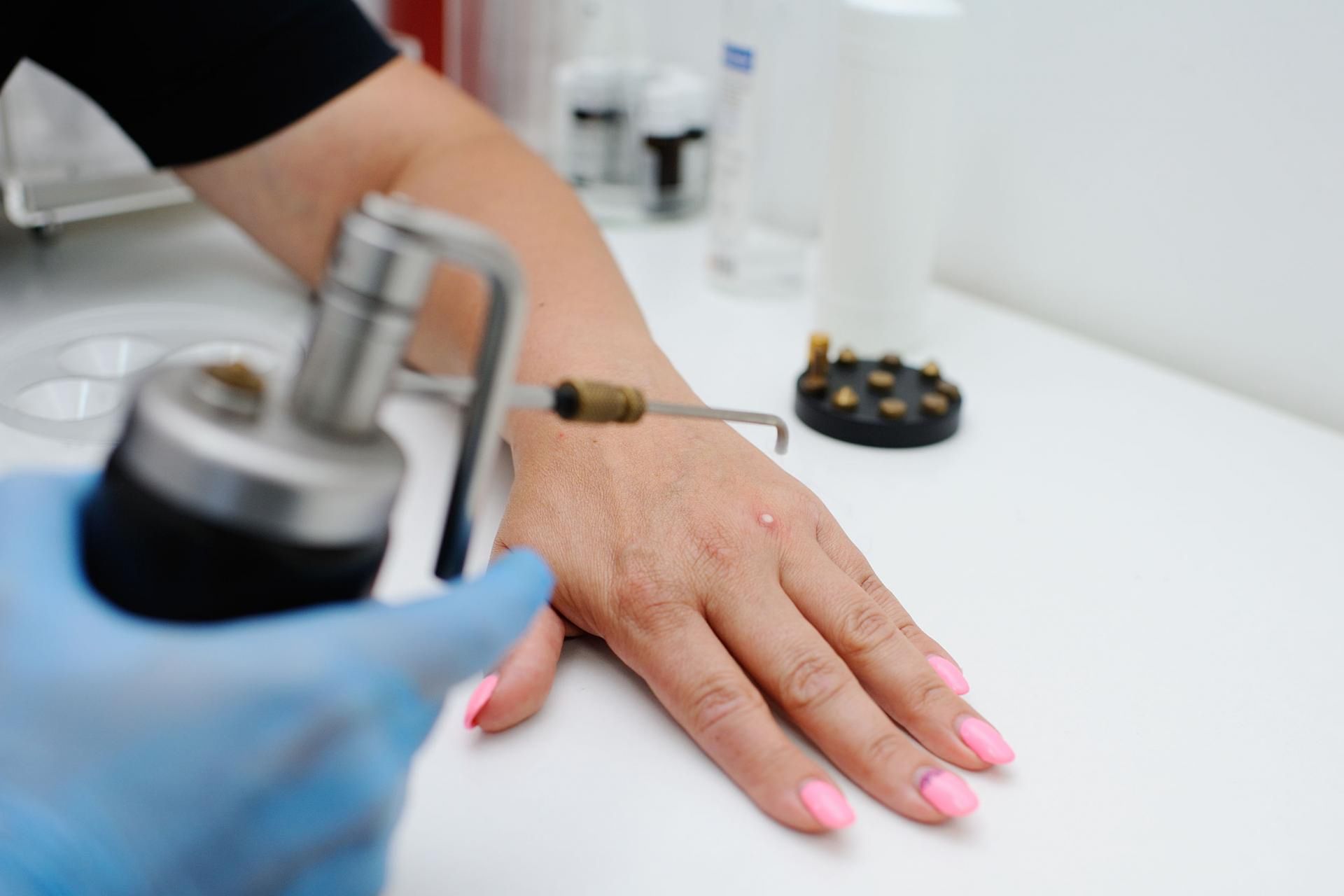 Naturalnym sposobem na kurzajki jest stosowanie okładu z czosnkiem.