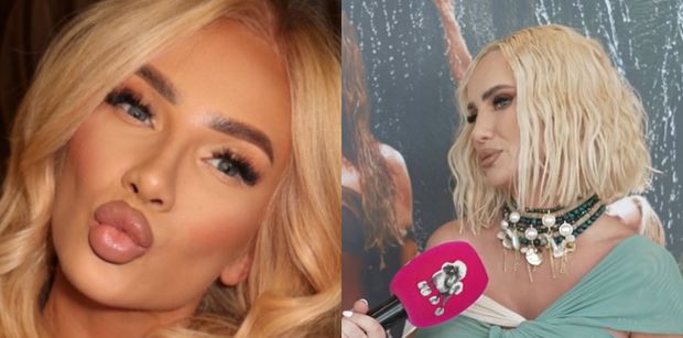 Izabela Macudzińska wymienia, co sobie poprawiła i uspokaja: "Nie jestem zwolenniczką medycyny estetycznej. Ja się NIE OSTRZYKUJĘ" (WIDEO)