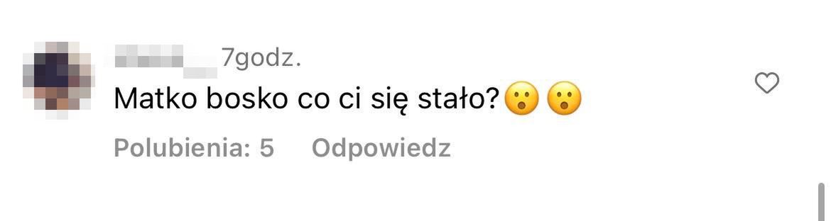 Ewel0na zaprezentowała "nową twarz". Fani apelują o rozwagę