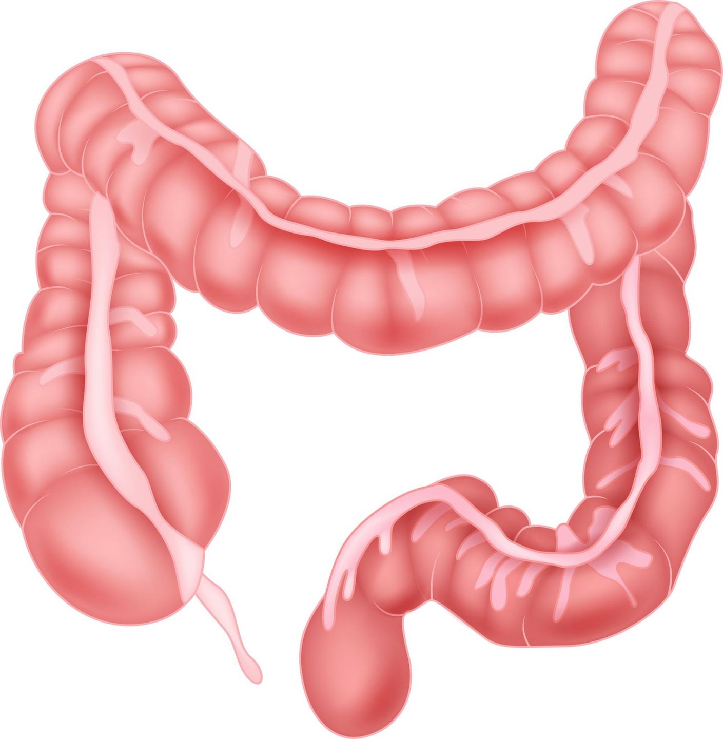 Najczęstsze choroby jelita grubego to rak jelita grubego oraz wrzodziejące zapalenie jelita grubego