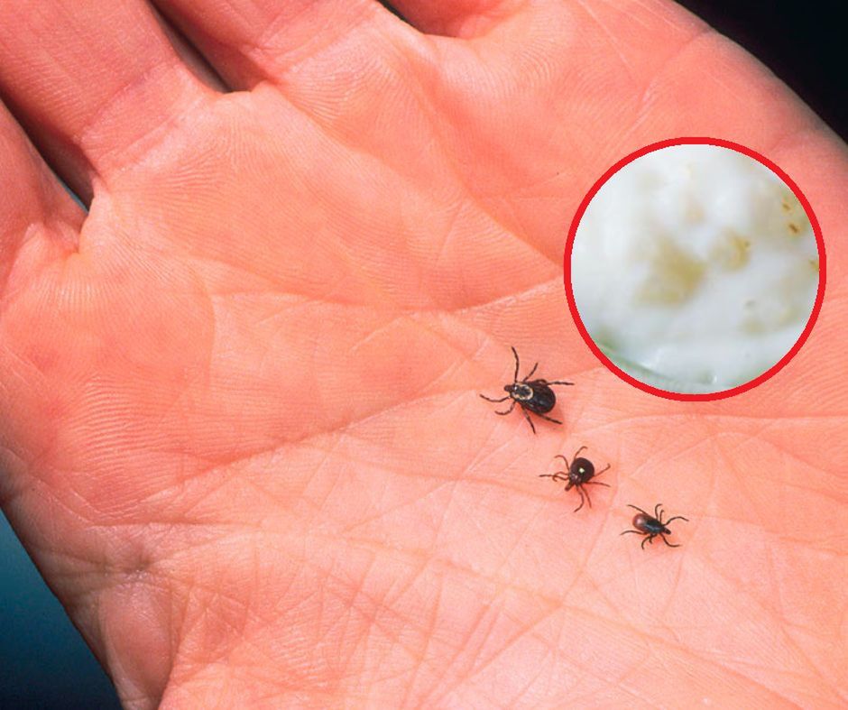 Genialny sposób na kleszcze. Nałóż cienką warstwę na skórę