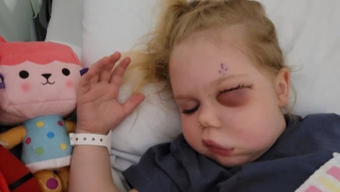 Lilly przeszła już sześć operacji