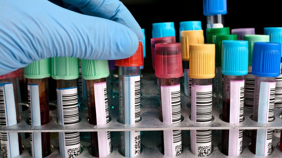 Badanie krwi w celu wykrycia anemii