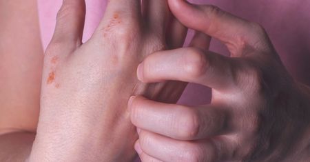 Jak pokonać strach przed ciężką alergią?