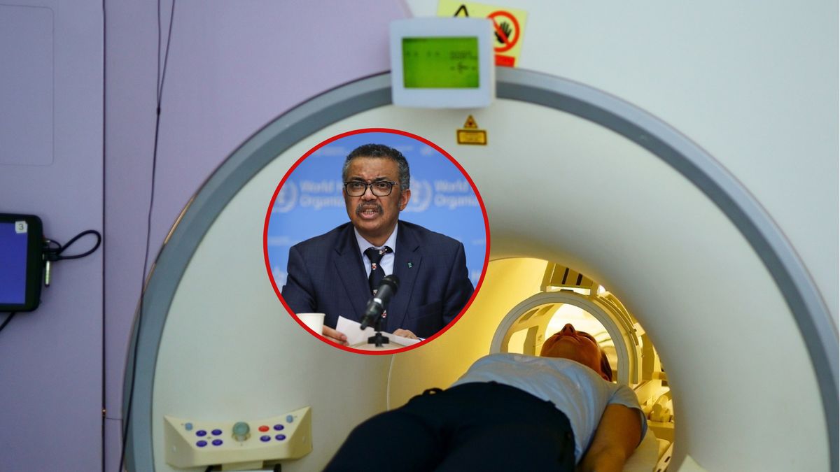 Szef WHO apeluje: rak zabija, a nie musi - wystarczy zmiana stylu życia i regularne badania