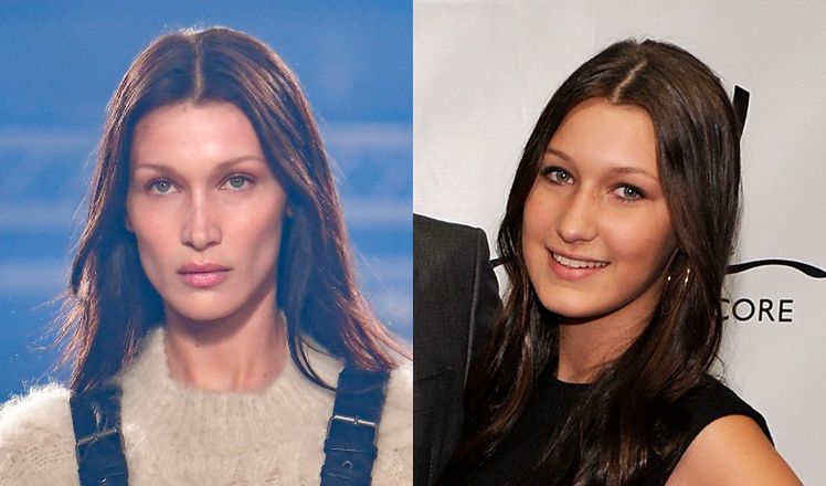 Bella Hadid przyznała się do operacji nosa