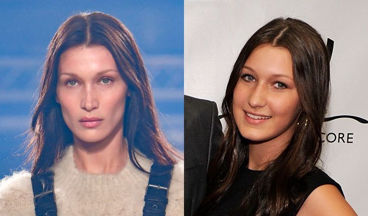 Bella Hadid w końcu przyznała się do operacji nosa… W WIEKU 14 LAT! "Żałuję"