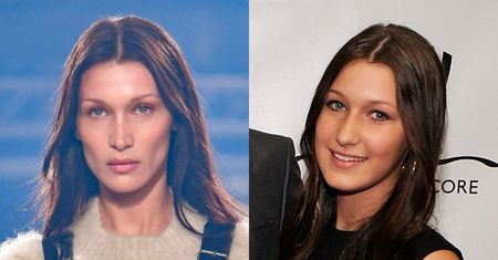 Bella Hadid w końcu przyznała się do operacji nosa… W WIEKU 14 LAT! "Żałuję"