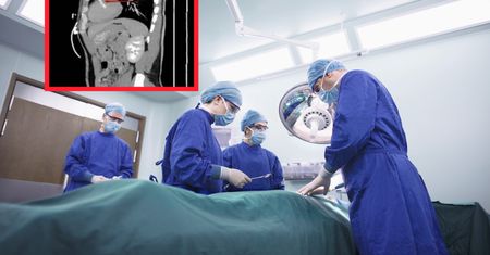 35-latek zgłosił się na SOR. Niepokojące znalezisko w sercu