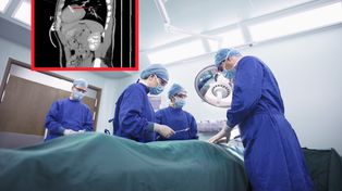 35-latek zgłosił się na SOR. Niepokojące znalezisko w sercu