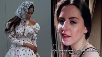 Julia von Stein zestawiła poliftingowy wygląd ze STARYMI zdjęciami. Jak inna osoba?