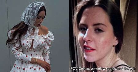 Julia von Stein zestawiła poliftingowy wygląd ze STARYMI zdjęciami. Jak inna osoba?