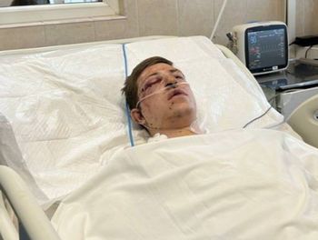 Rosjanie uderzyli w autobus. Zginęli górnicy. Ujawnili nazwiska