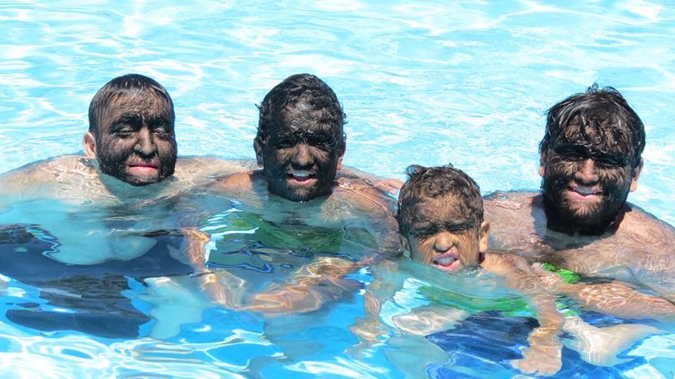 Prawie połowa rodziny Jezusa Aceves'a cierpi na nieuleczalną hipertrichozę