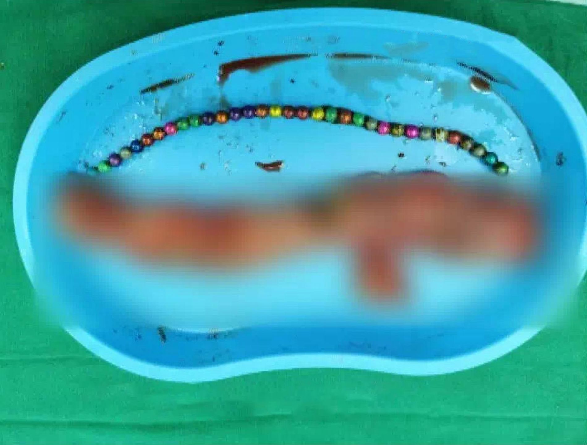 W przewodzie pokarmowym znaleziono 33 kulki 