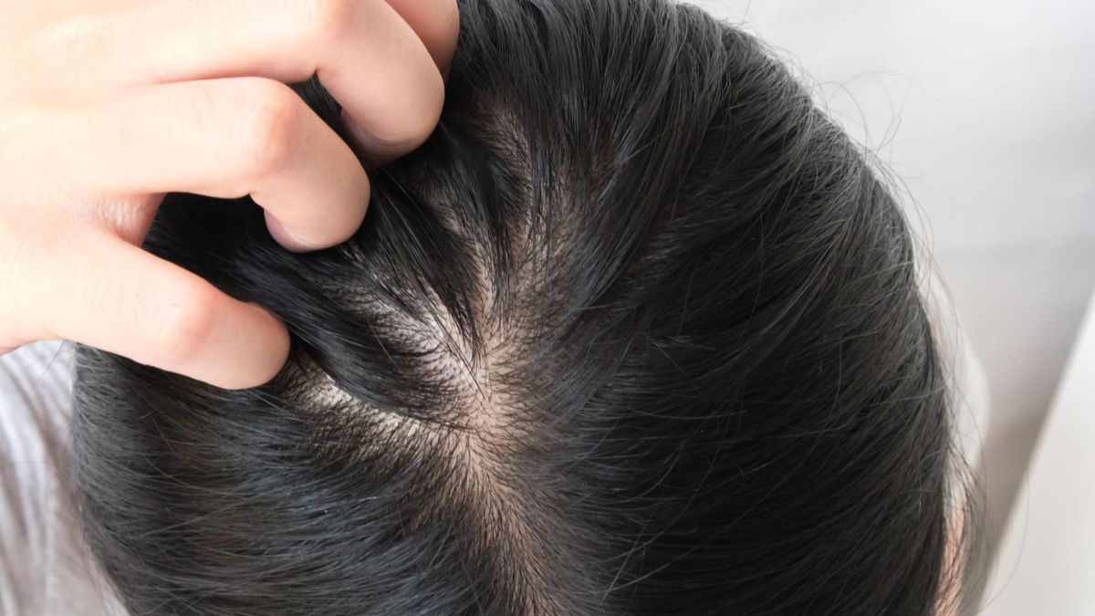 Swędzenie skóry głowy może być objawem niedoczynności tarczycy 