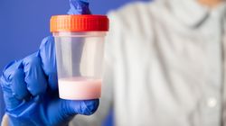 Posiew nasienia - co bada, przygotowanie i przebieg badania