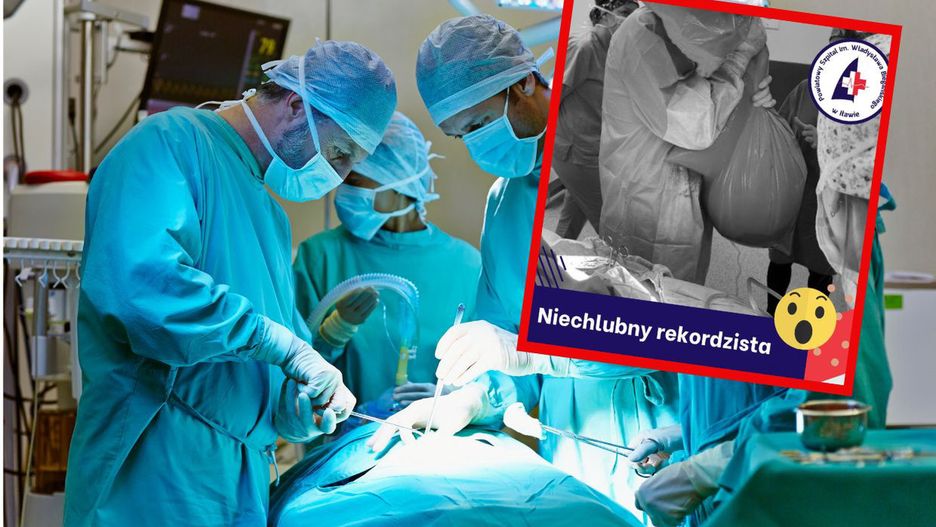 Lekarze z Powiatowego Szpitala im. Władysława Biegańskiego w Iławie usunęli gigantycznego guza jajnika