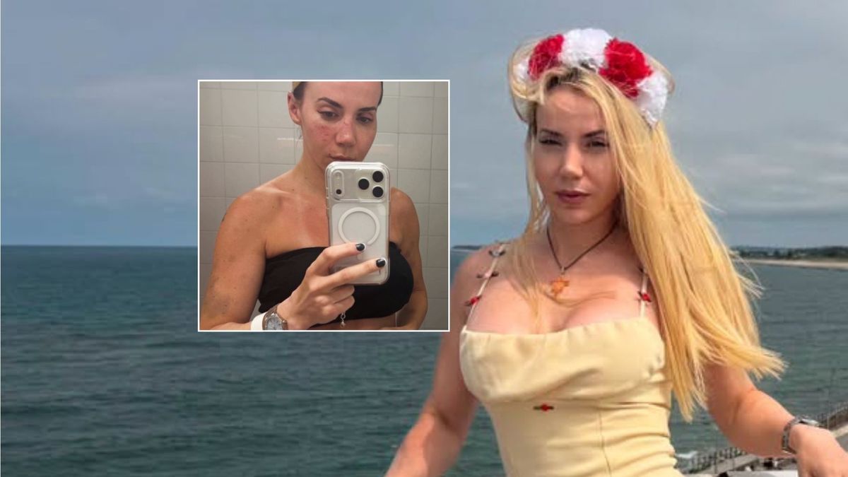 Marianna Schreiber pokazała obrażenia