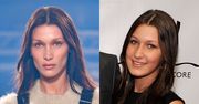 Bella Hadid w końcu przyznała się do operacji nosa… W WIEKU 14 LAT! "Żałuję"