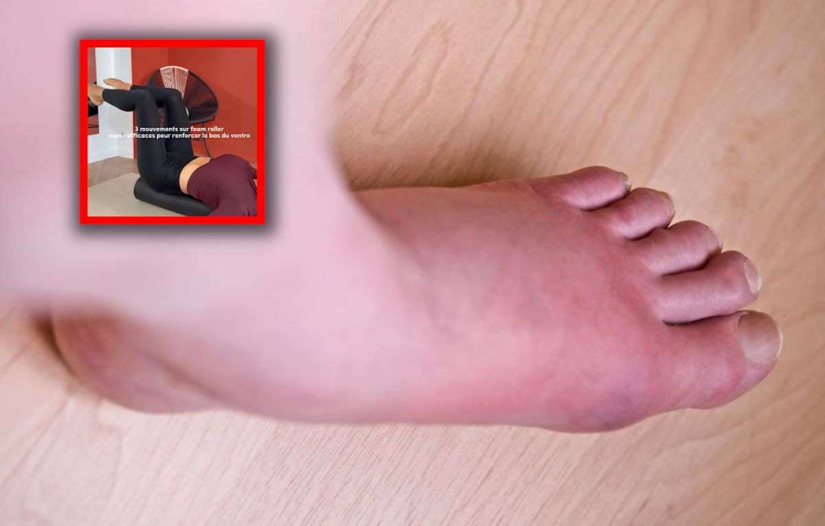 Przez upał masz opuchnięte nogi? To przyniesie ci ulgę