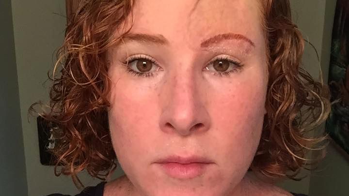 "Przestańcie smażyć swoją skórę". Dramatyczny apel kobiety, która wygrała z czerniakiem