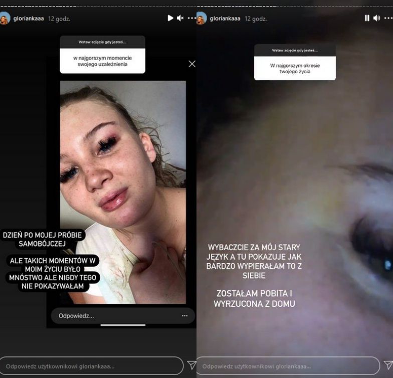 Glorianka wspomina okres uzależnienia