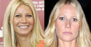 43-letnia Gwyneth Paltrow "wypełniła usta" i "wygładziła zmarszczki"? (ZDJĘCIA)