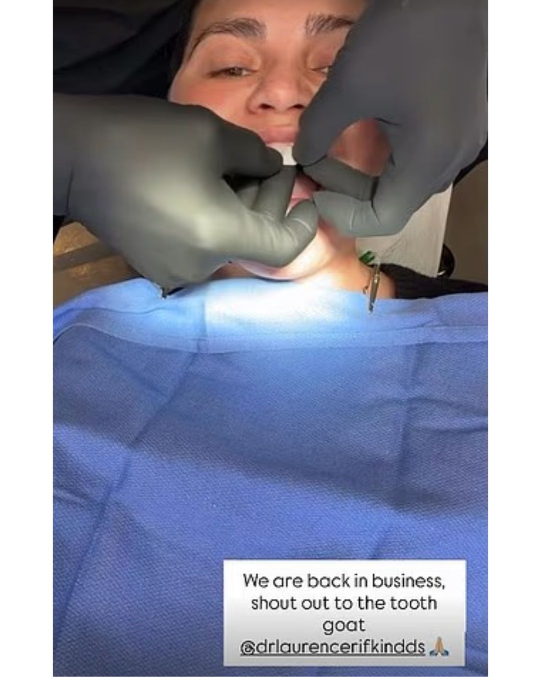 Chrissy Teigen ukruszyła sobie zęba