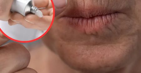 Kup maść za 10 złotych. Zmarszczki zaczną znikać