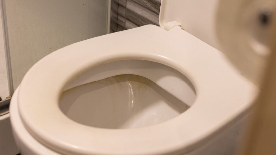 Te sposoby przywrócą czystość twojej toalecie