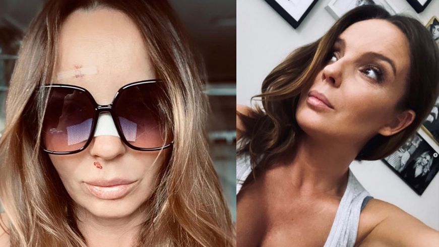 Agnieszka Włodarczyk ujawnia, jak się czuje 