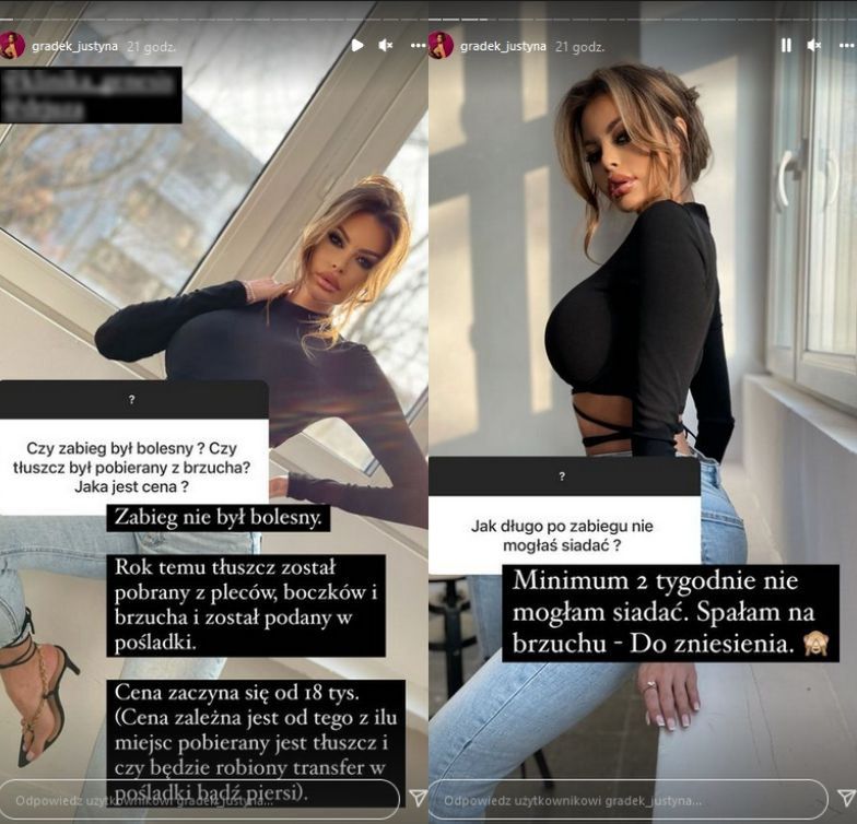 Justyna Gradek zachwala zabieg na pośladki