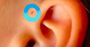 Czy wiesz, co oznacza dziurka przy uchu dziecka? Może być bardzo niebezpieczna